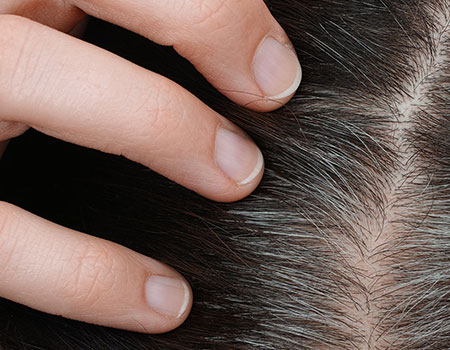 Why does hair turn grey?