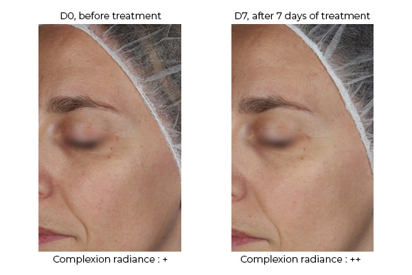 Visualization of the effect of REVILIENCE<sup>®</sup> on the radiance complexion of young volunteers.