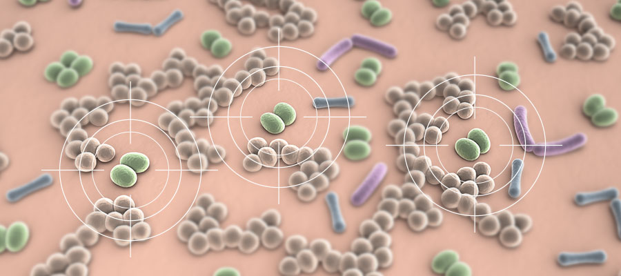 Targeting of the S. hominis, a bacterium responsible for odorous molecules