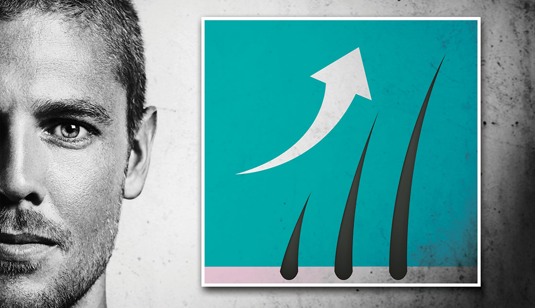 HAIRGENYL®, trigger hair dynamics to regain density HAIRGENYL®, trigger hair dynamics to regain density