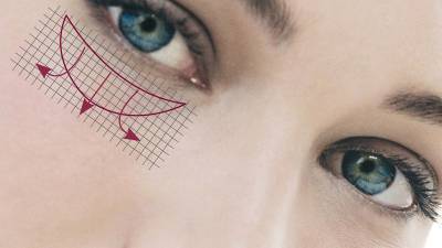 EYE REGENER
